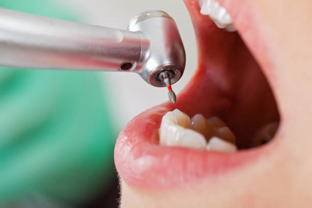 Best Emergency Broken Tooth Repair in Pine Lawn, MO